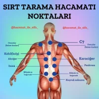 Extant 20 Adet 7 Cm Hacamat Ve Masaj Kupası - Vakum Pompası Hediyeli